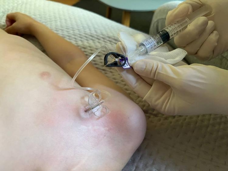 DZIECI Z HEMOFILIĄ CZĘSTO PANICZNIE BOJĄ SIĘ DOTYKU. DLACZEGO?